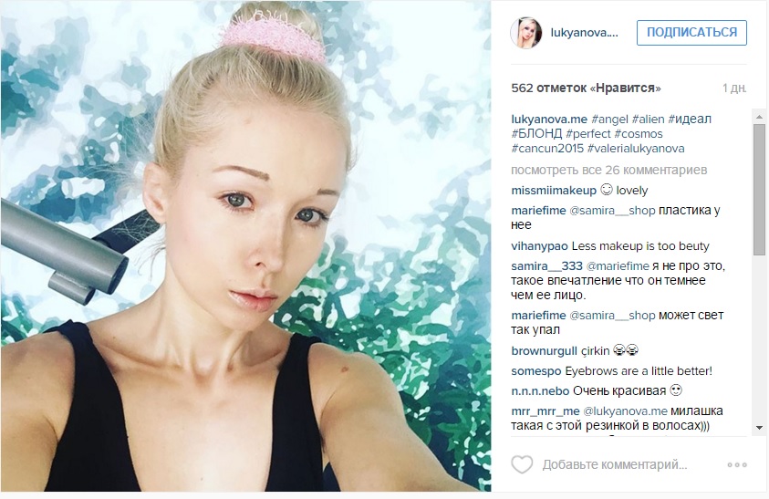 «Живая Барби»