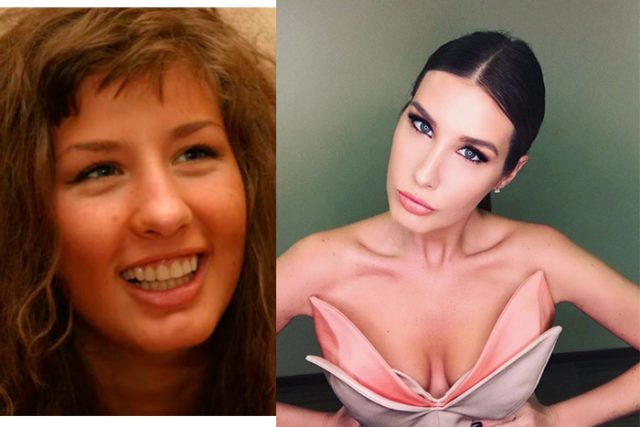 Кети Топурия фото до и после пластики на PEOPLETALK