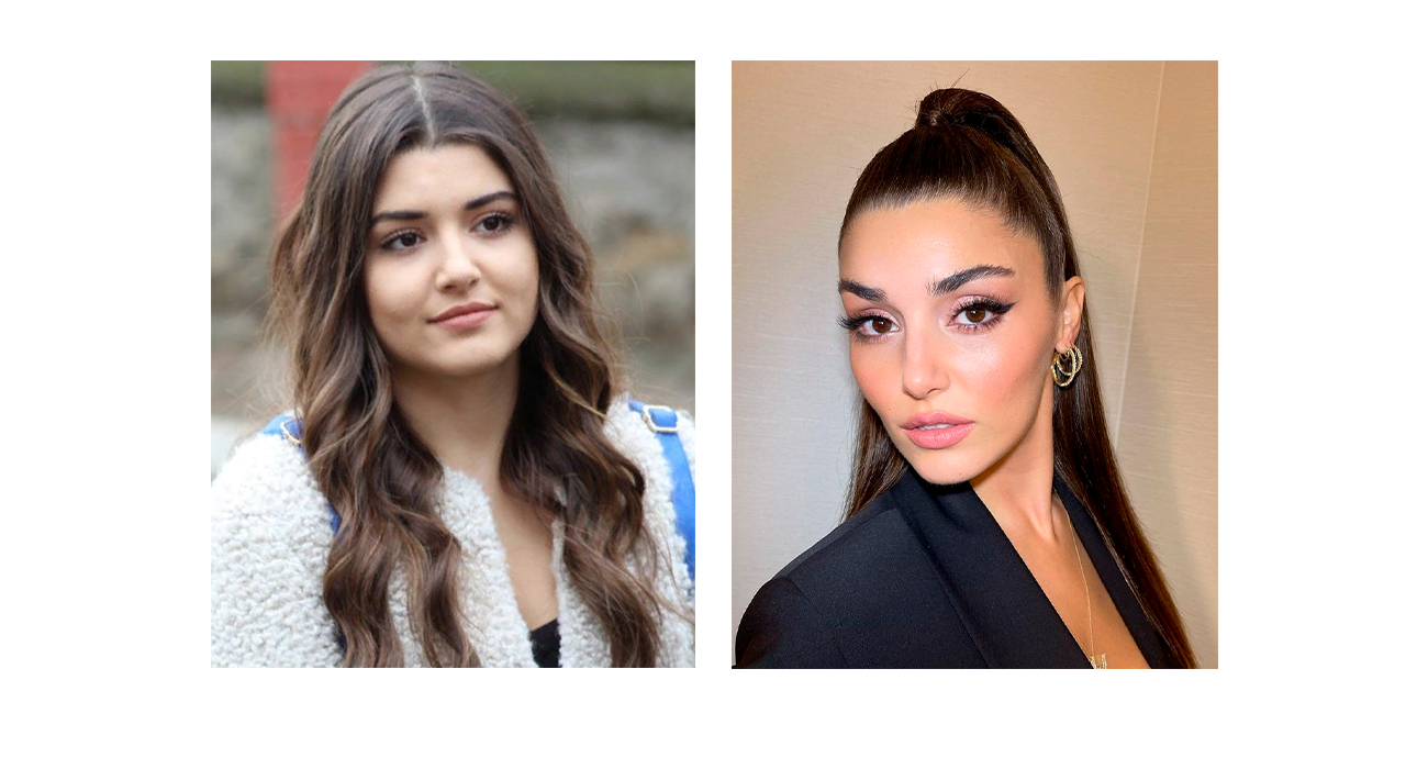 Эда йылдыз фото до похудения